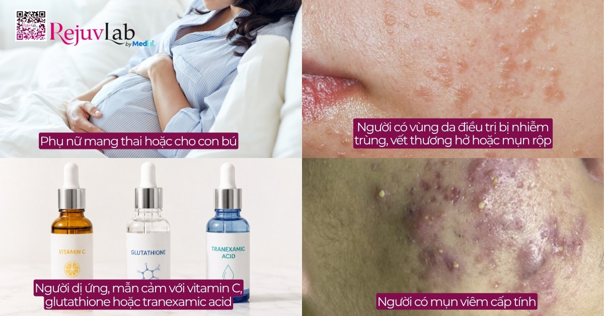 Review tiêm meso trị thâm mụn: Hiệu quả thực tế và chi phí trọn gói 7 Review tiêm meso trị thâm mụn: Hiệu quả thực tế và chi phí trọn gói 6
