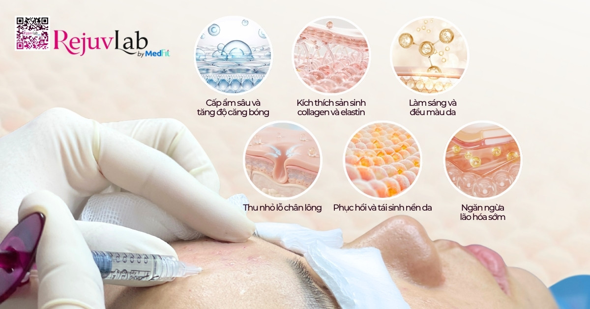 Tiêm meso trẻ hóa da giá bao nhiêu và hiệu quả thực tế như thế nào? 1