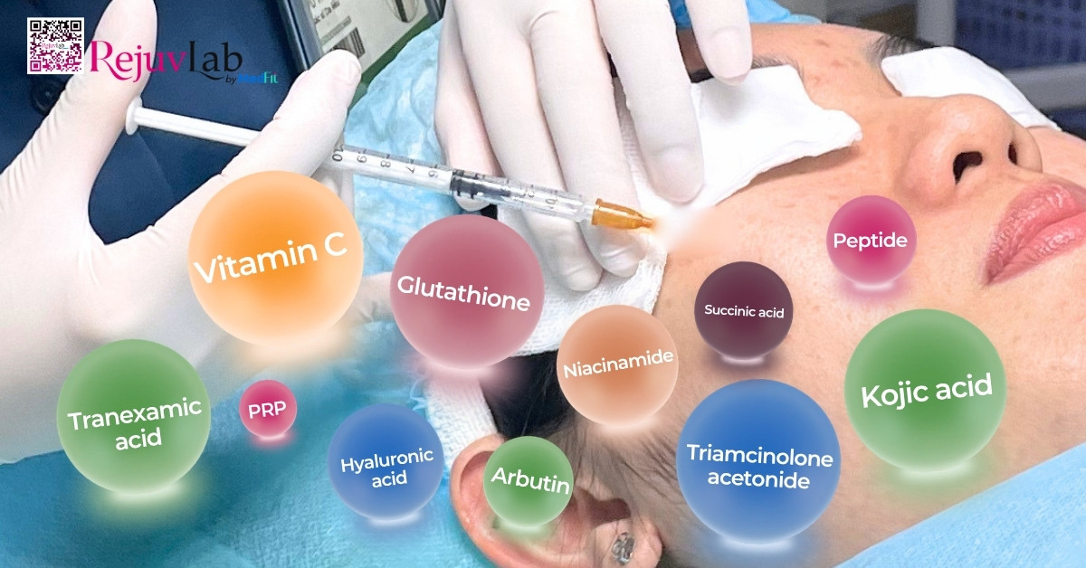 Review tiêm meso trị thâm mụn: Hiệu quả thực tế và chi phí trọn gói 2 Review tiêm meso trị thâm mụn: Hiệu quả thực tế và chi phí trọn gói 1