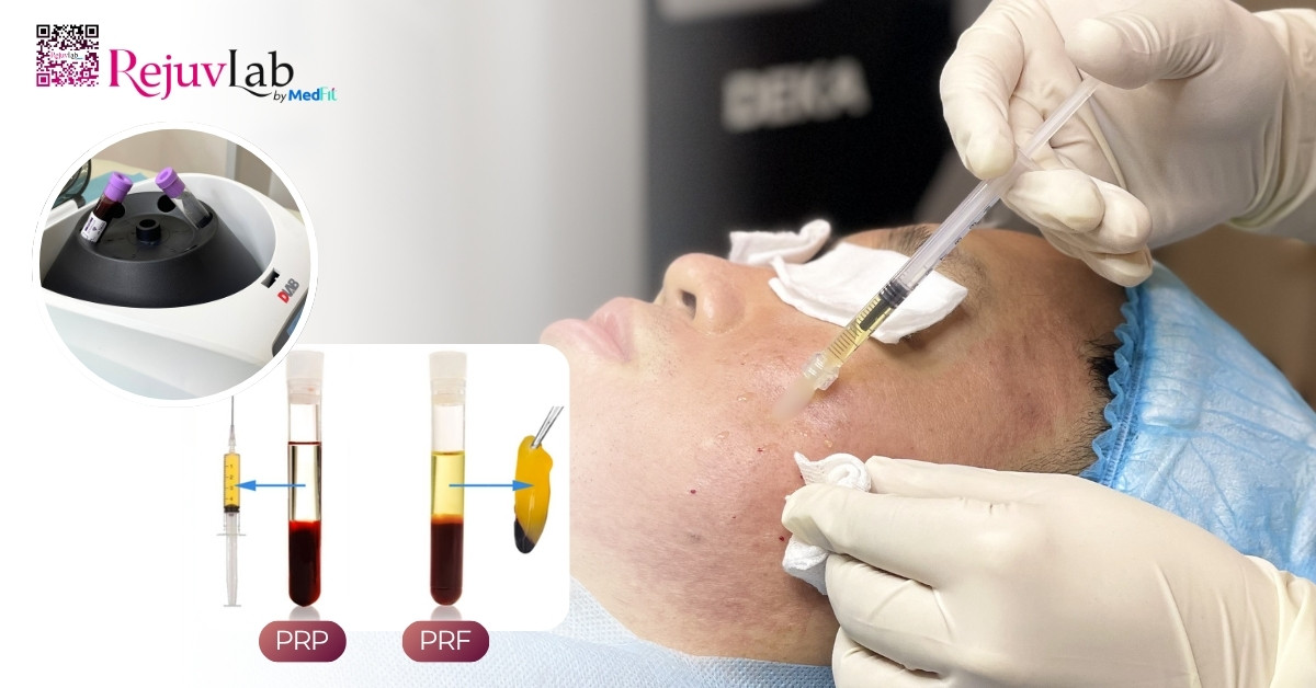 Review tác dụng của mesotherapy trong trẻ hóa da và điều trị sắc tố 17 Review tác dụng của mesotherapy trong trẻ hóa da và điều trị sắc tố 16
