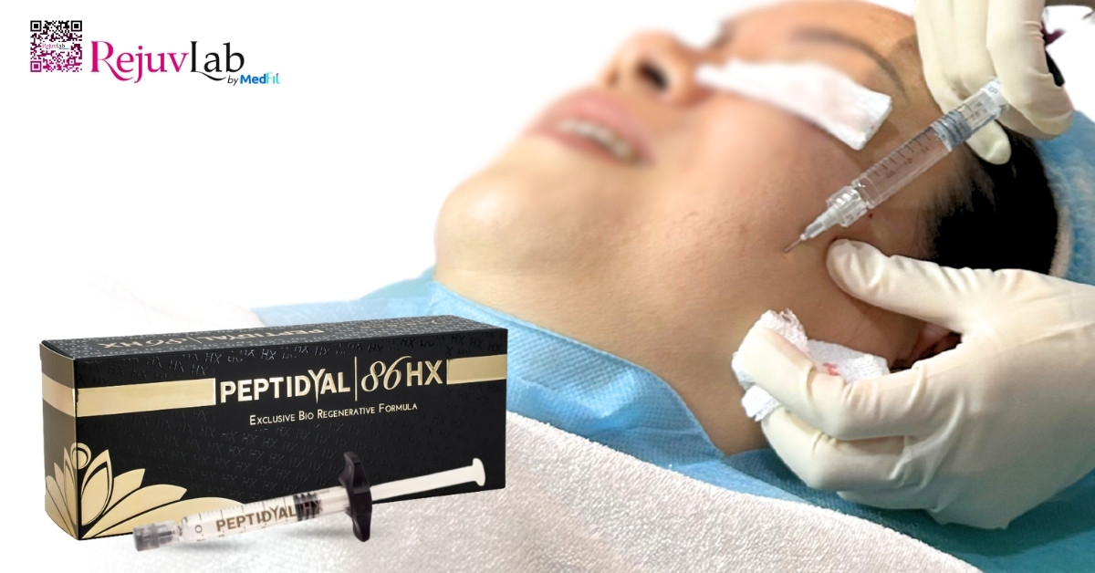 Review tác dụng của mesotherapy trong trẻ hóa da và điều trị sắc tố 21 Review tác dụng của mesotherapy trong trẻ hóa da và điều trị sắc tố 20