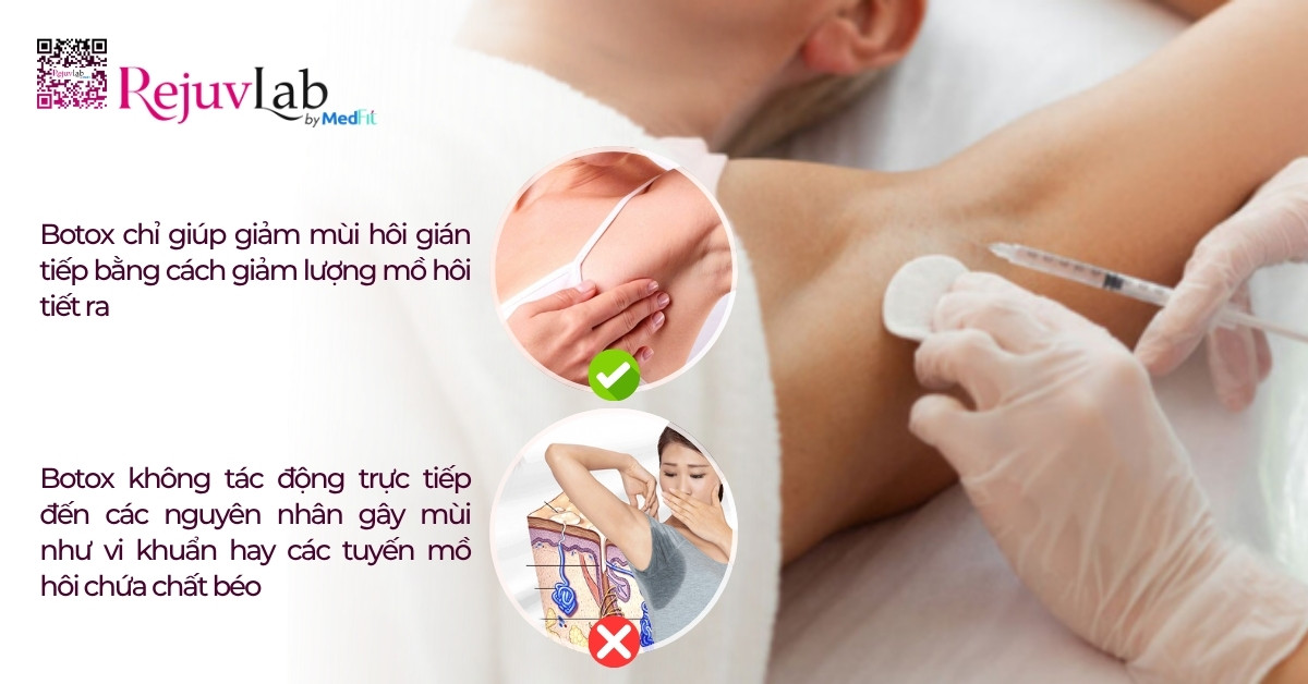 Tiêm meso trị hôi nách có vĩnh viễn không? Review hiệu quả và chi phí 7 Tiêm meso trị hôi nách có vĩnh viễn không? Review hiệu quả và chi phí 6