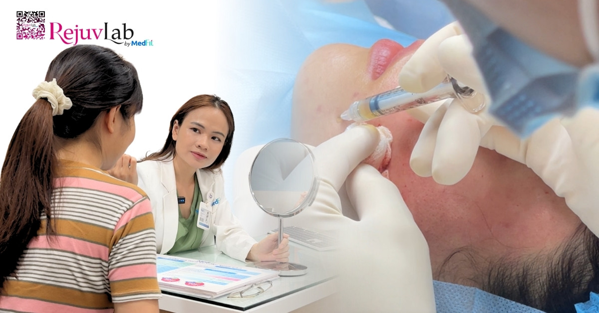 Review tiêm meso trị thâm mụn: Hiệu quả thực tế và chi phí trọn gói 10 Review tiêm meso trị thâm mụn: Hiệu quả thực tế và chi phí trọn gói 9