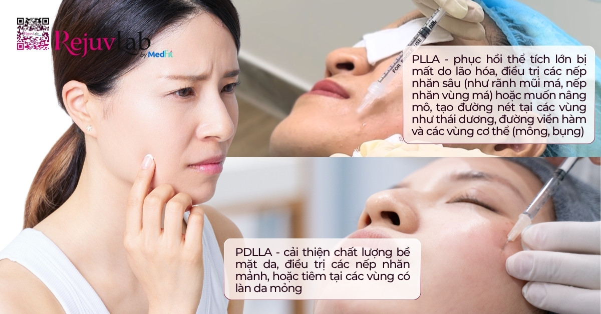 Trẻ hóa da với PLLA hoặc PDLLA, nên lựa chọn sản phẩm như thế nào? 6 Trẻ hóa da với PLLA hoặc PDLLA, nên lựa chọn sản phẩm như thế nào? 5