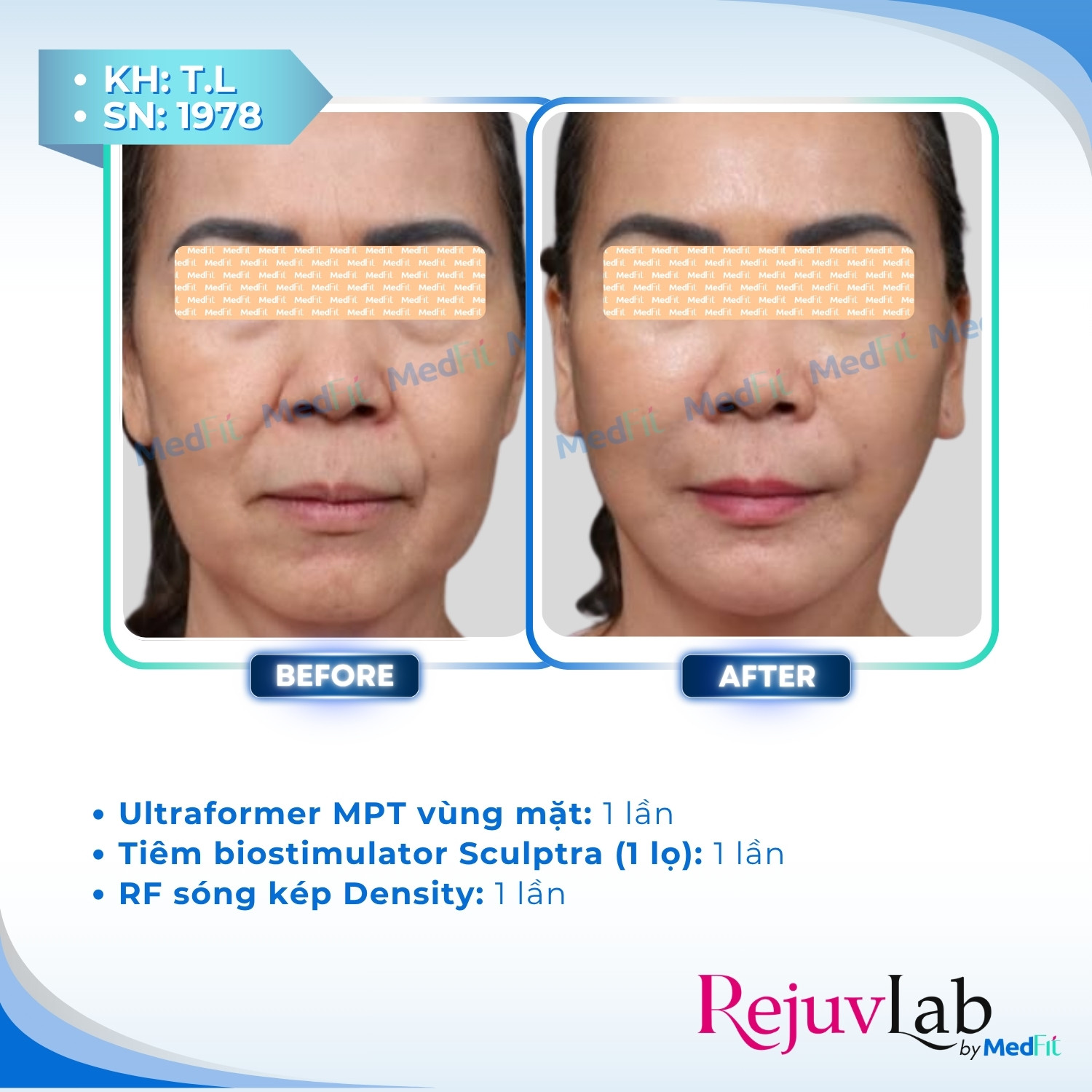 HydroxyFill 13
