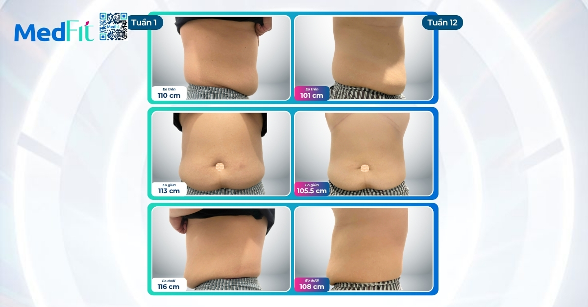 Bận rộn không cản hành trình giảm cân, khách hàng 29 tuổi giảm 12,2kg và 24,5cm vòng eo sau 12 tuần 5