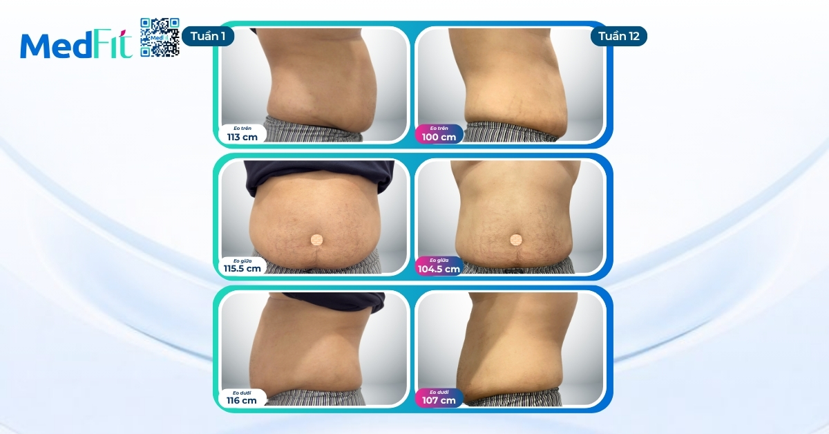 Khách hàng đi công tác, du lịch thường xuyên vẫn giảm 13kg và 33cm vòng eo sau 12 tuần tại MedFit 5