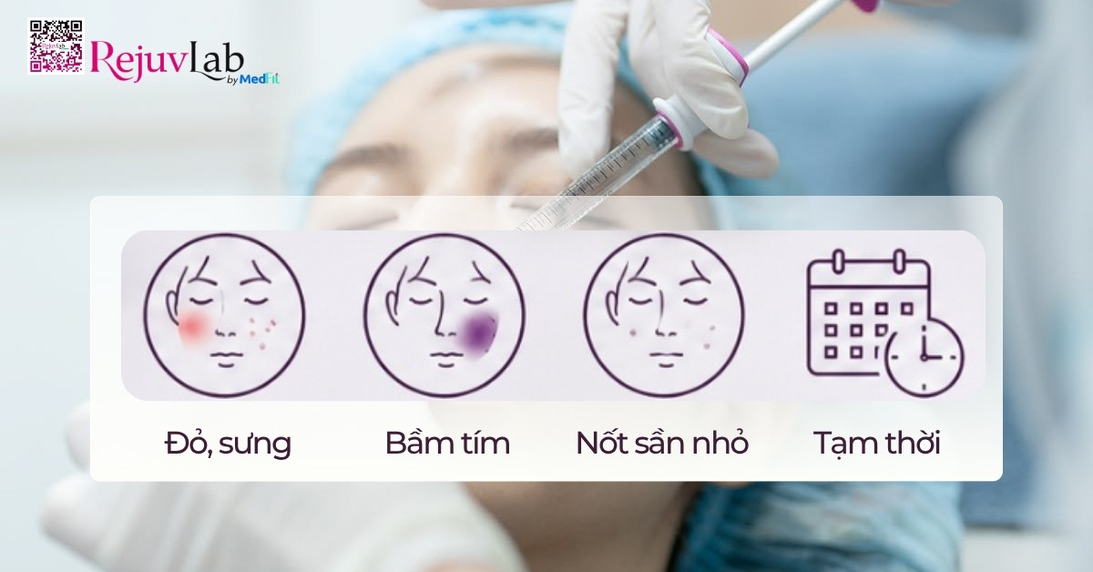 Filler Juvederm có mấy loại? Cách chọn dòng Juvederm phù hợp cho từng vùng da 7