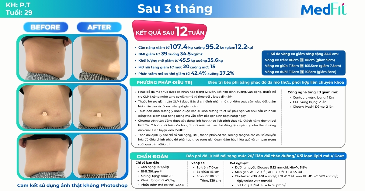Bận rộn không cản hành trình giảm cân, khách hàng 29 tuổi giảm 12,2kg và 24,5cm vòng eo sau 12 tuần 9