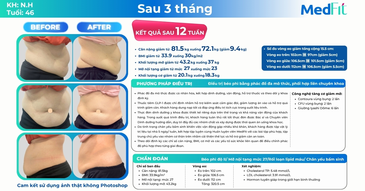 Đôi chân nặng nề không cản bước hành trình giảm cân, khách hàng giảm 9,4kg và 15,5cm vòng eo sau 12 tuần tại MedFit 9