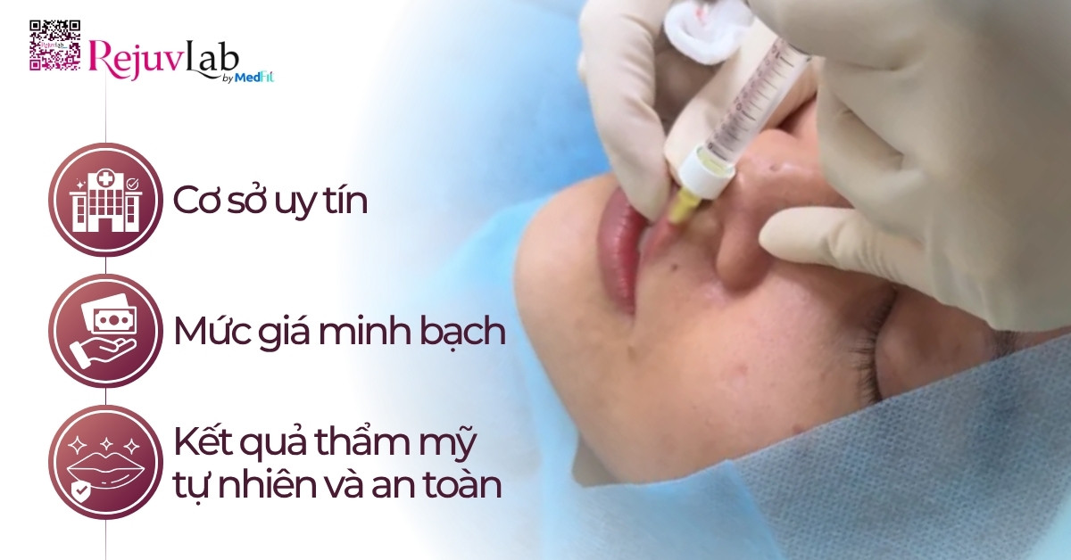 Tiêm filler môi giữ được bao lâu? Chi phí thế nào? 9 Tiêm filler môi giữ được bao lâu? Chi phí thế nào? 8