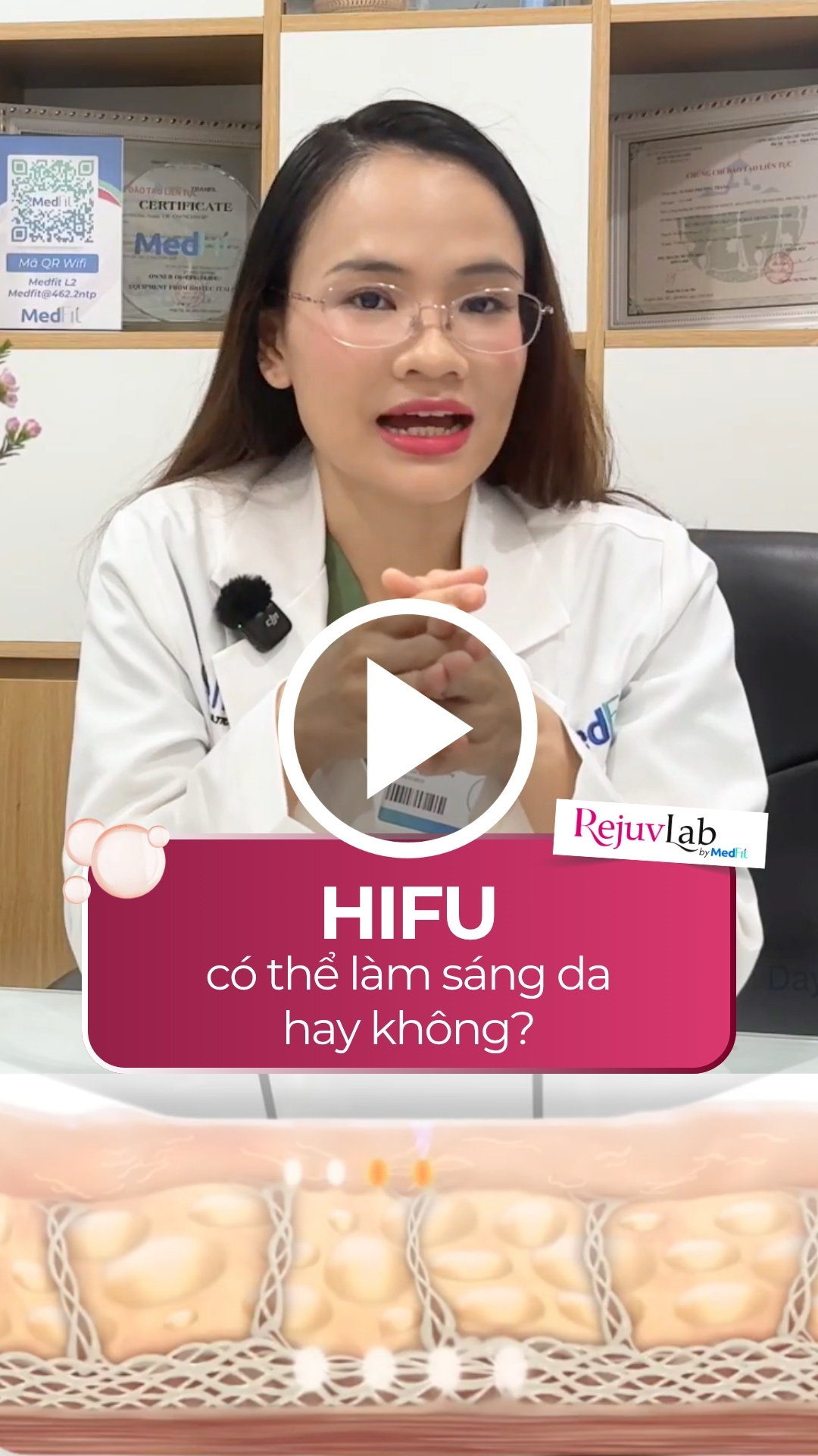 Ultherapy Prime - Tiêu chuẩn vàng của HIFU trong nâng cơ - trẻ hoá da 4
