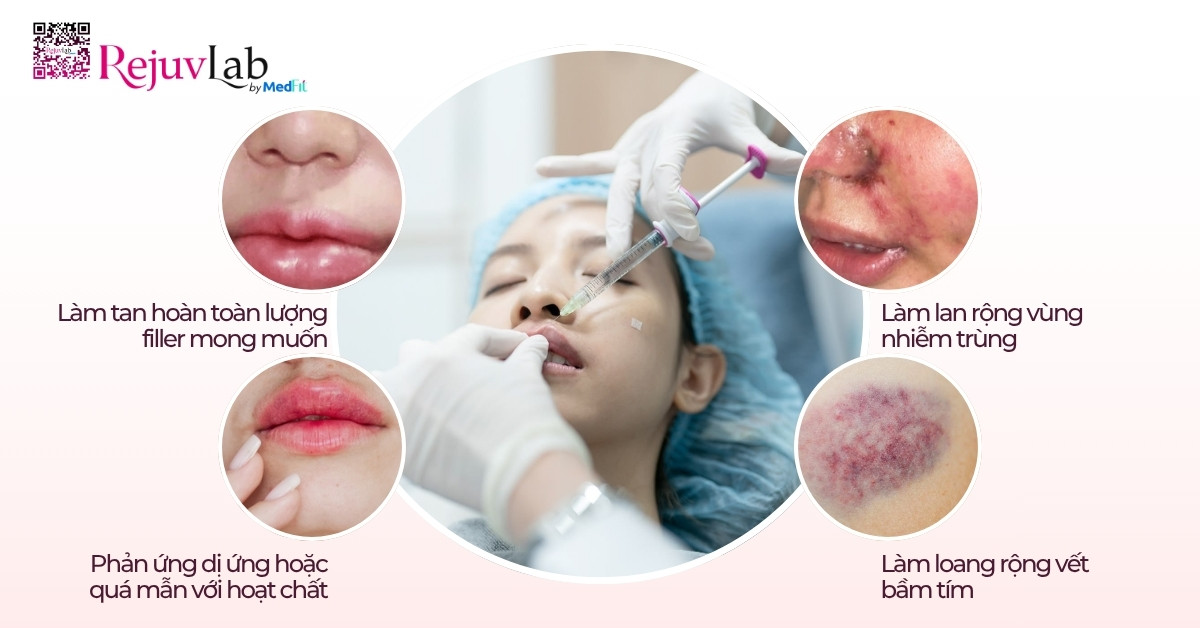 Tiêm tan filler có ảnh hưởng gì không? Khi nào nên tiêm? 6
