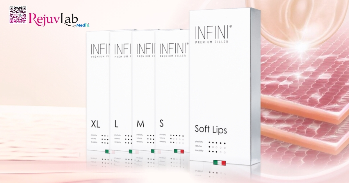 1cc filler giá bao nhiêu? Tổng hợp giá các loại filler phổ biến trên thị trường 18