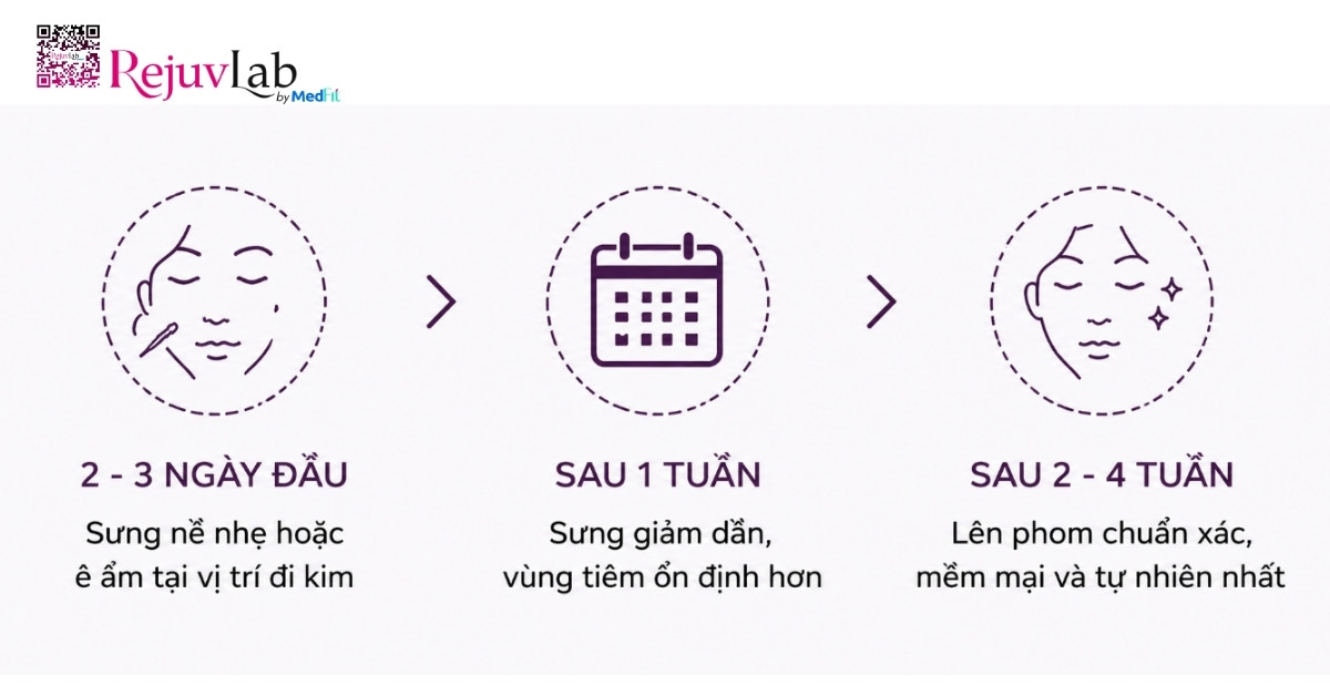 Bảng giá filler Juvederm mới nhất theo dòng sản phẩm và vùng tiêm 9