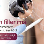 Tiêm filler má bao lâu thì mềm và vào form chuẩn nhất? Bí quyết chăm sóc da tại nhà sau khi tiêm filler