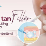 Tiêm tan filler có ảnh hưởng gì không? Khi nào nên tiêm?