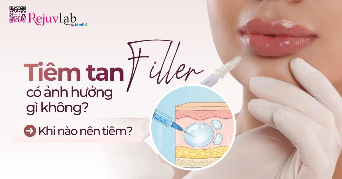 Kiến thức 10