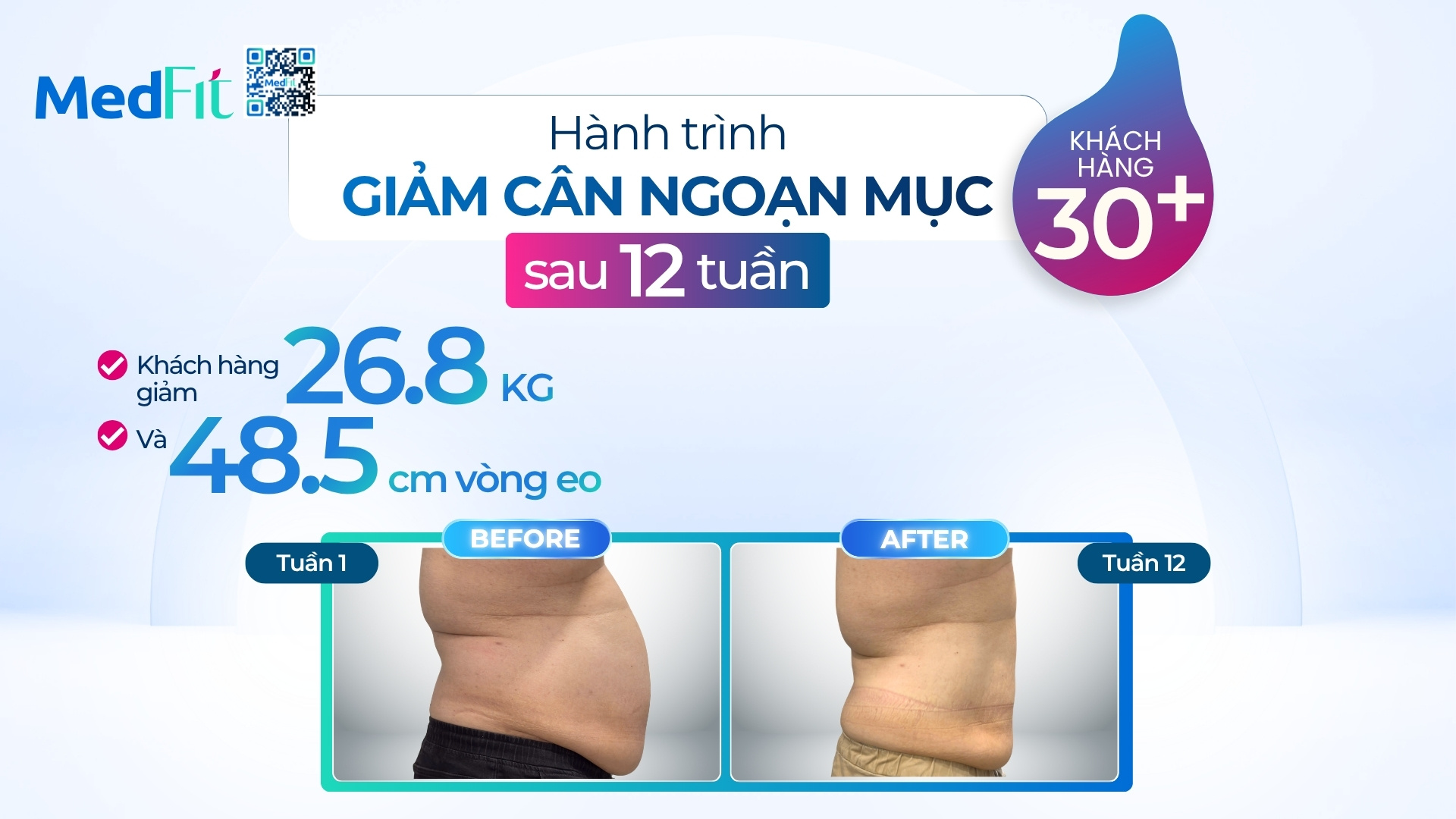 Thumb clip kh H.P