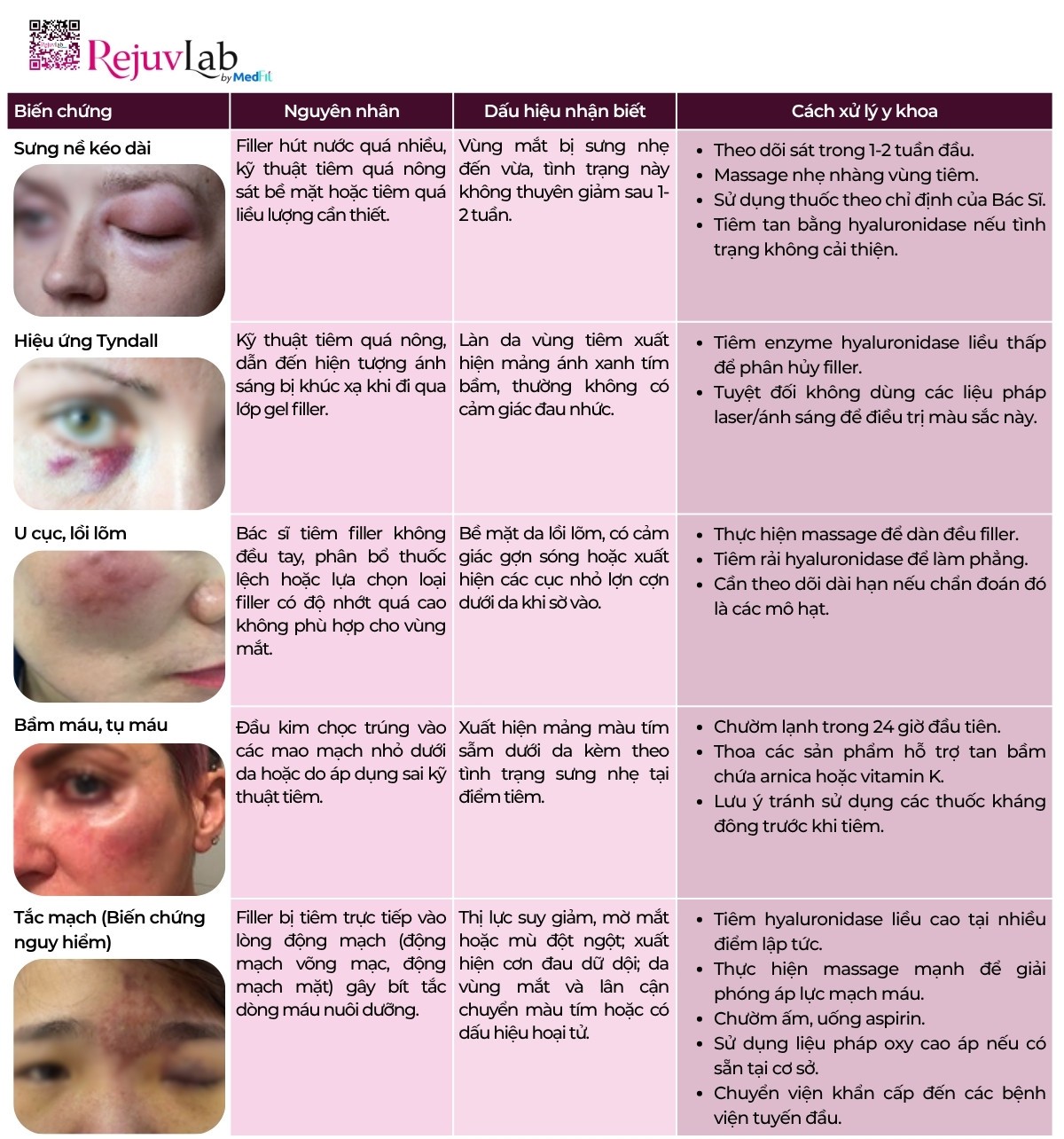 Tiêm filler làm đầy hốc mắt có nguy hiểm không và những ai nên tránh? 3