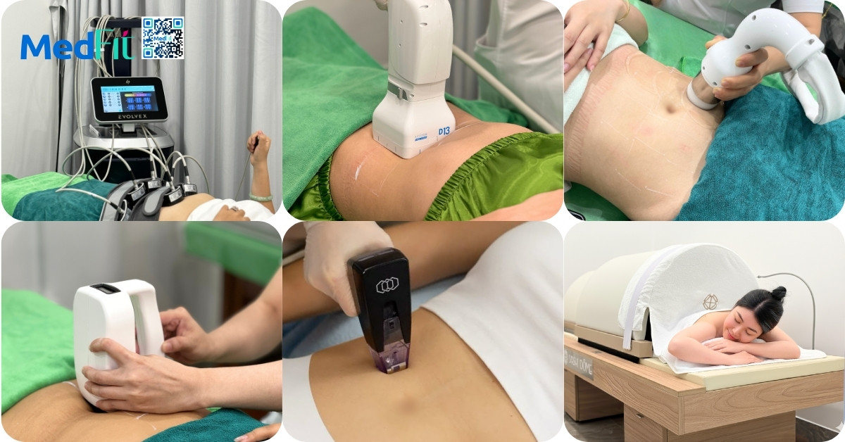 Review: Thuốc giảm cân Lishou có tốt không? 19