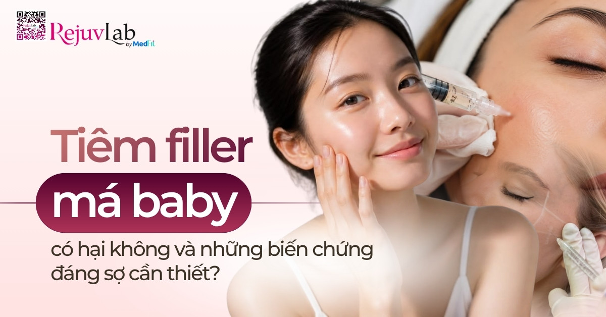 Thumb Tiêm filler má baby