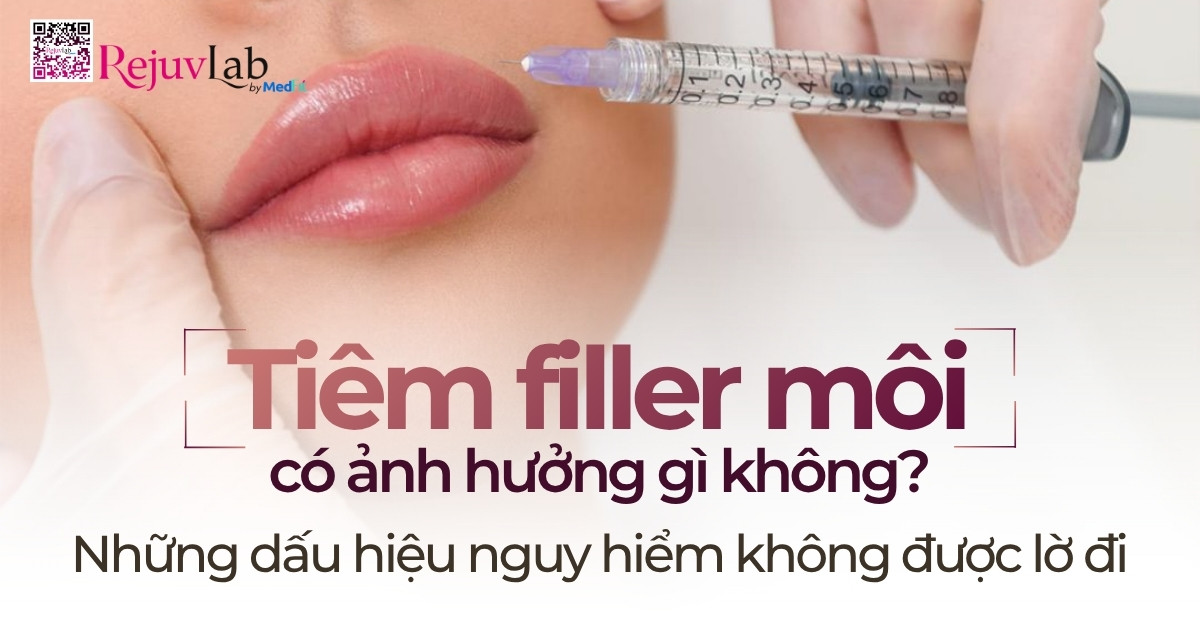 Kiến thức 11