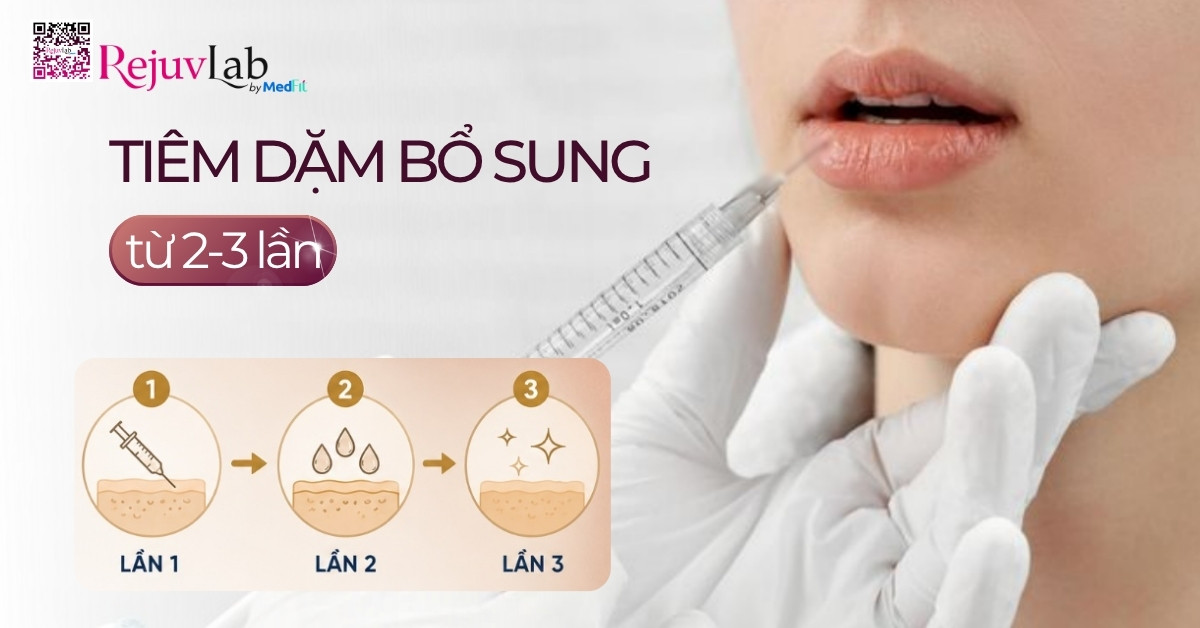 Sau khi tiêm tan filler cần kiêng gì và bao lâu thì tiêm lại được? 4 Sau khi tiêm tan filler cần kiêng gì và bao lâu thì tiêm lại được? 3