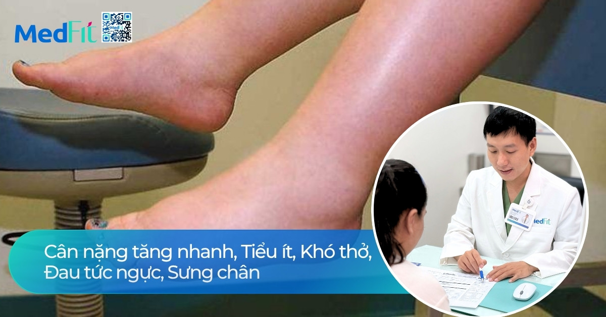 Ăn mặn có tăng cân không? Mối liên hệ giữa muối và cân nặng 9 Ăn mặn có tăng cân không? Mối liên hệ giữa muối và cân nặng 8