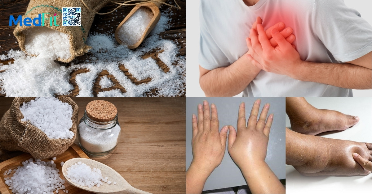 Ăn mặn có tăng cân không? Mối liên hệ giữa muối và cân nặng 4 Ăn mặn có tăng cân không? Mối liên hệ giữa muối và cân nặng 3