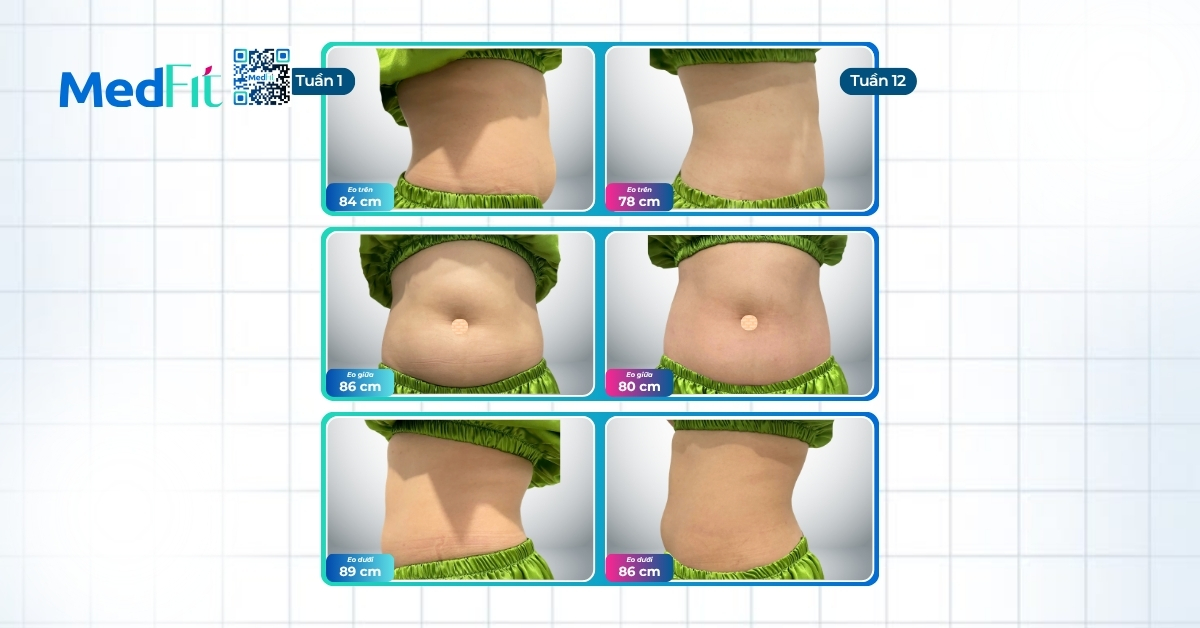 Khách hàng quay lại MedFit, giảm gần 6kg trong 12 tuần 6 Khách hàng quay lại MedFit, giảm gần 6kg trong 12 tuần 5