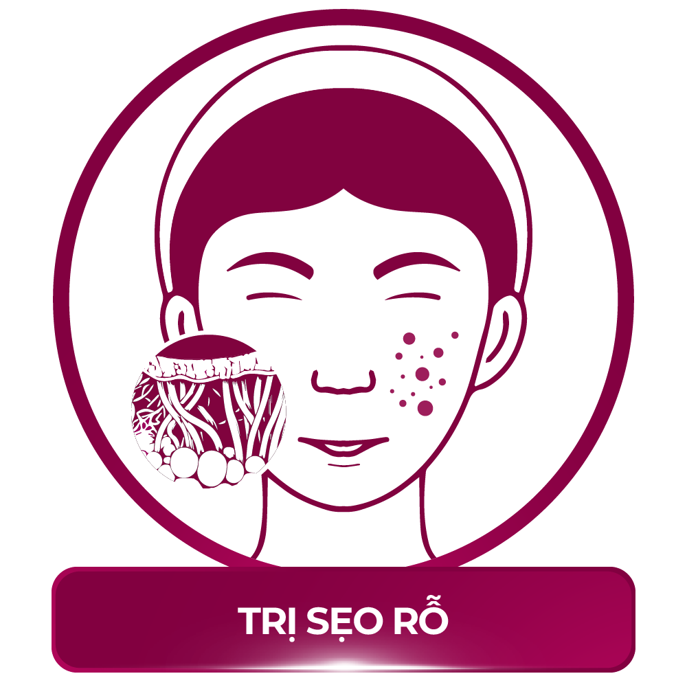 trị sẹo rỗ