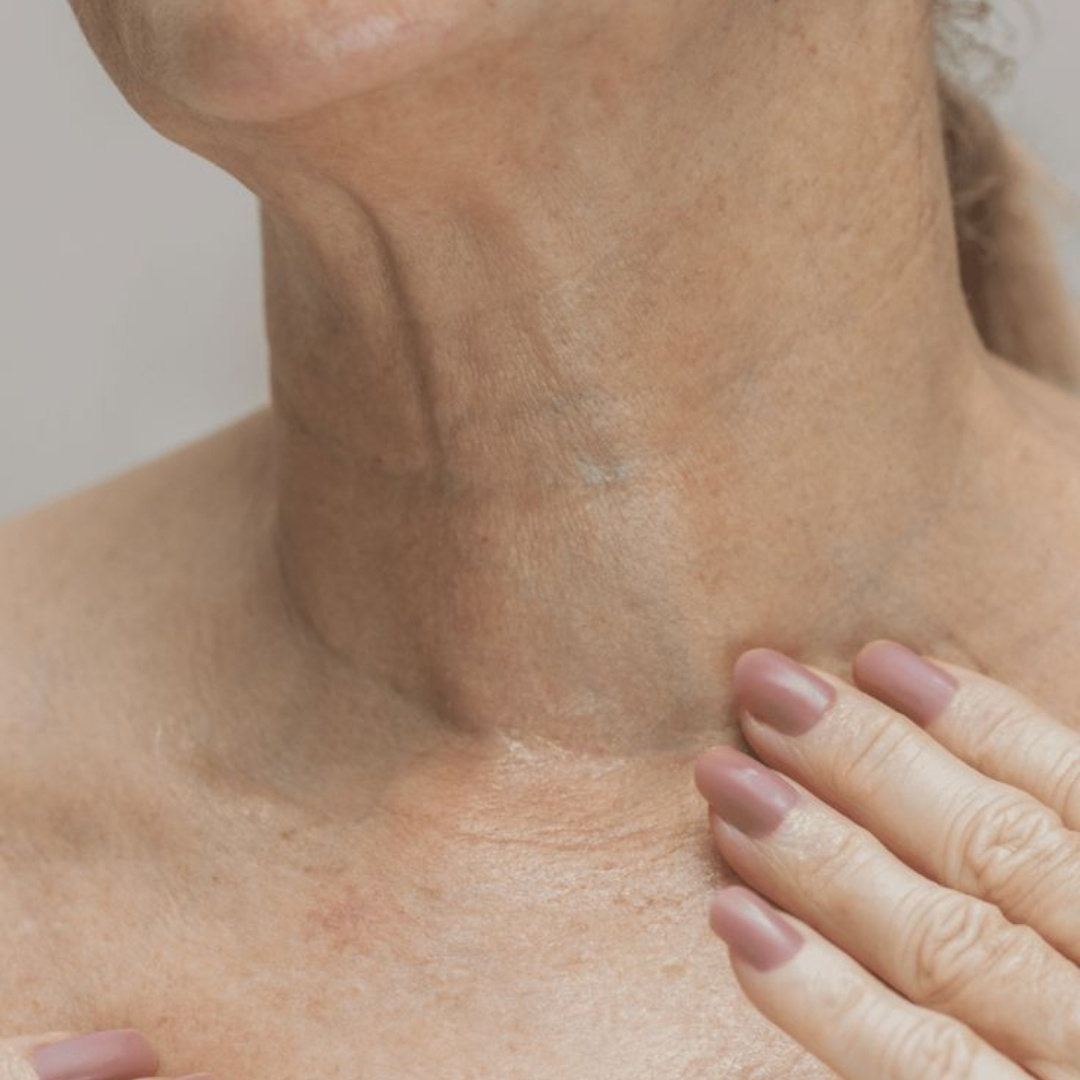 Lão hóa vùng cổ
