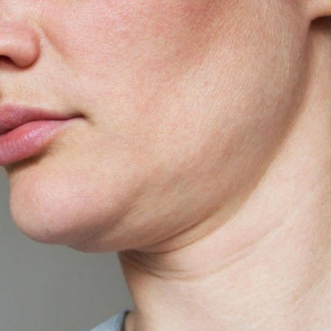 Cải thiện đường viền hàm và cằm