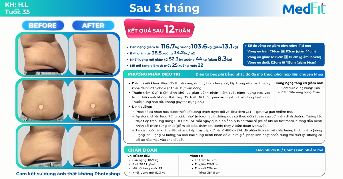 Kỹ sư IT giảm 13,1kg, 41,5cm vòng eo sau 12 tuần tại MedFit 10 Kỹ sư IT giảm 13,1kg, 41,5cm vòng eo sau 12 tuần tại MedFit 9