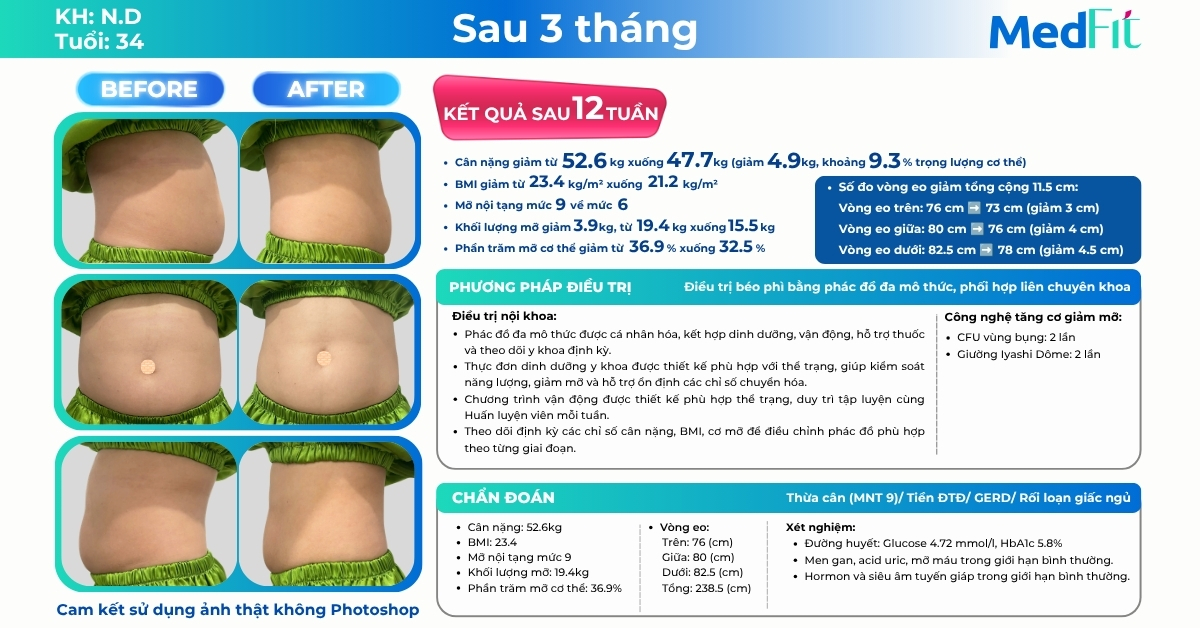Từ ngưỡng thừa cân về BMI bình thường, khách hàng giảm gần 5kg và 11,5cm vòng eo sau 12 tuần tại MedFit 9