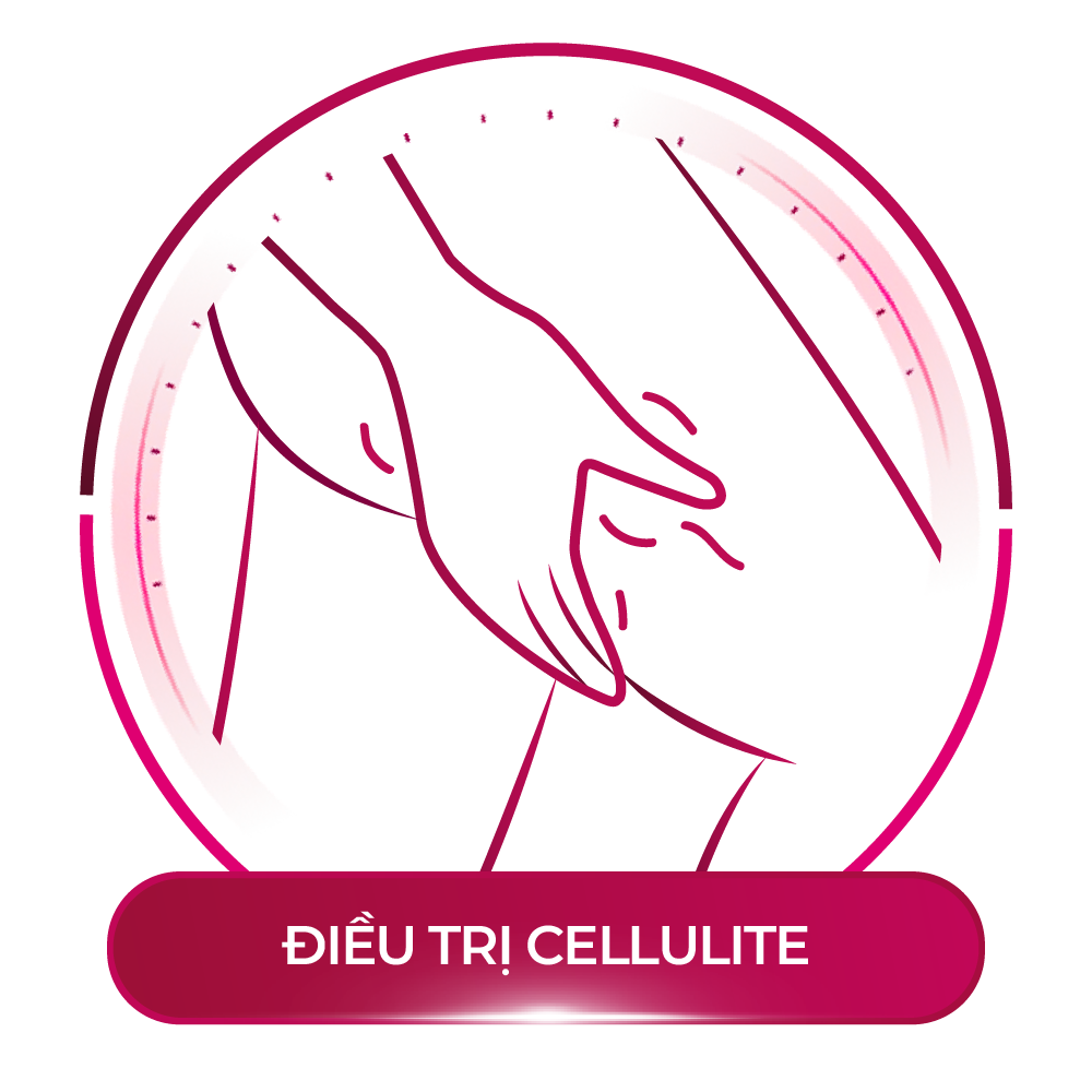 điều trị cellulite