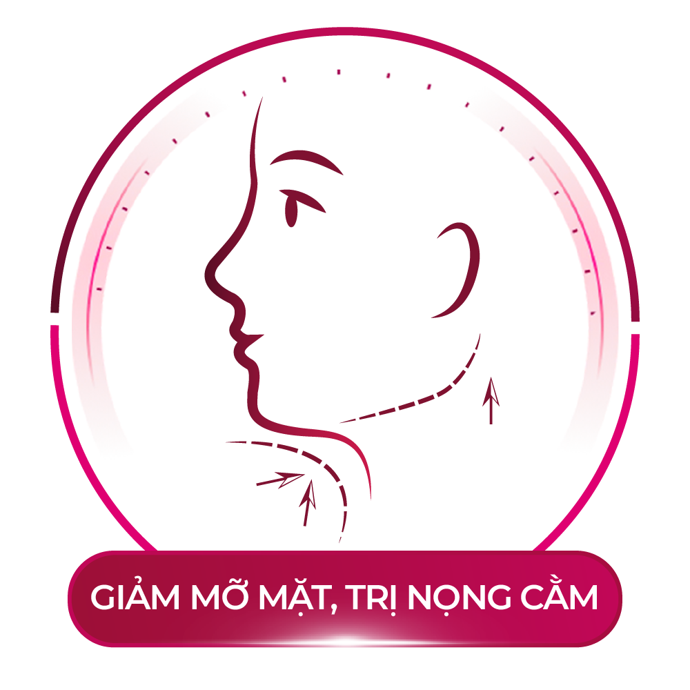 giảm mỡ mặt trị nọng cằm