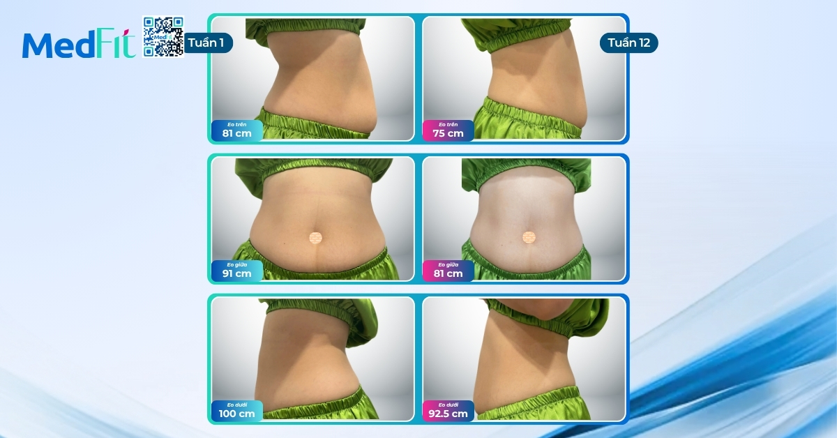 Mẹ sau sinh lấy lại vóc dáng, giảm gần 8kg sau 12 tuần tại MedFit 5