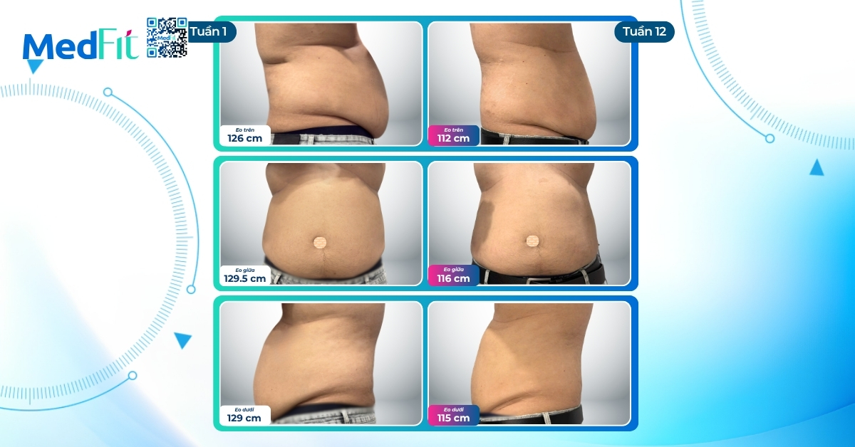 Kỹ sư IT giảm 13,1kg, 41,5cm vòng eo sau 12 tuần tại MedFit 8 Kỹ sư IT giảm 13,1kg, 41,5cm vòng eo sau 12 tuần tại MedFit 7
