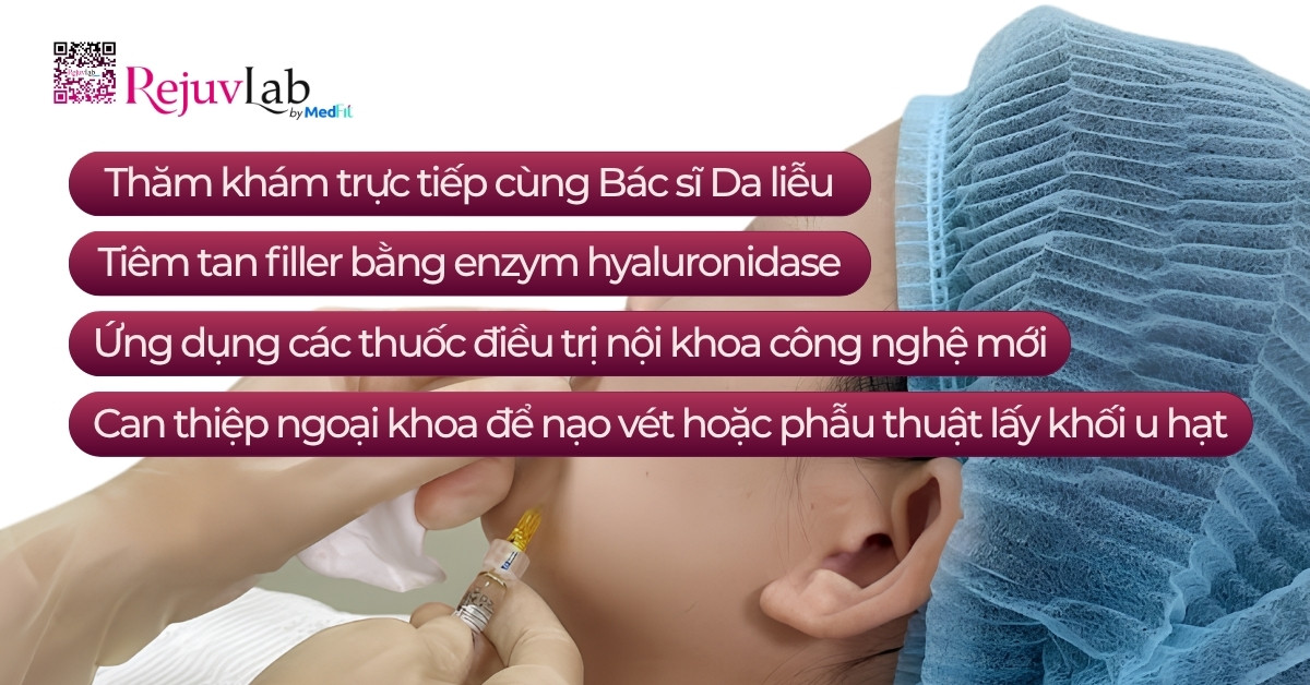 Tiêm filler bị cứng bao lâu? Cách xử lý an toàn 7
