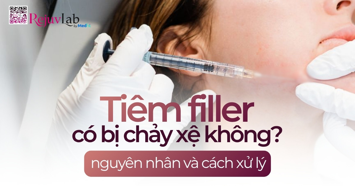 Trang chủ 101