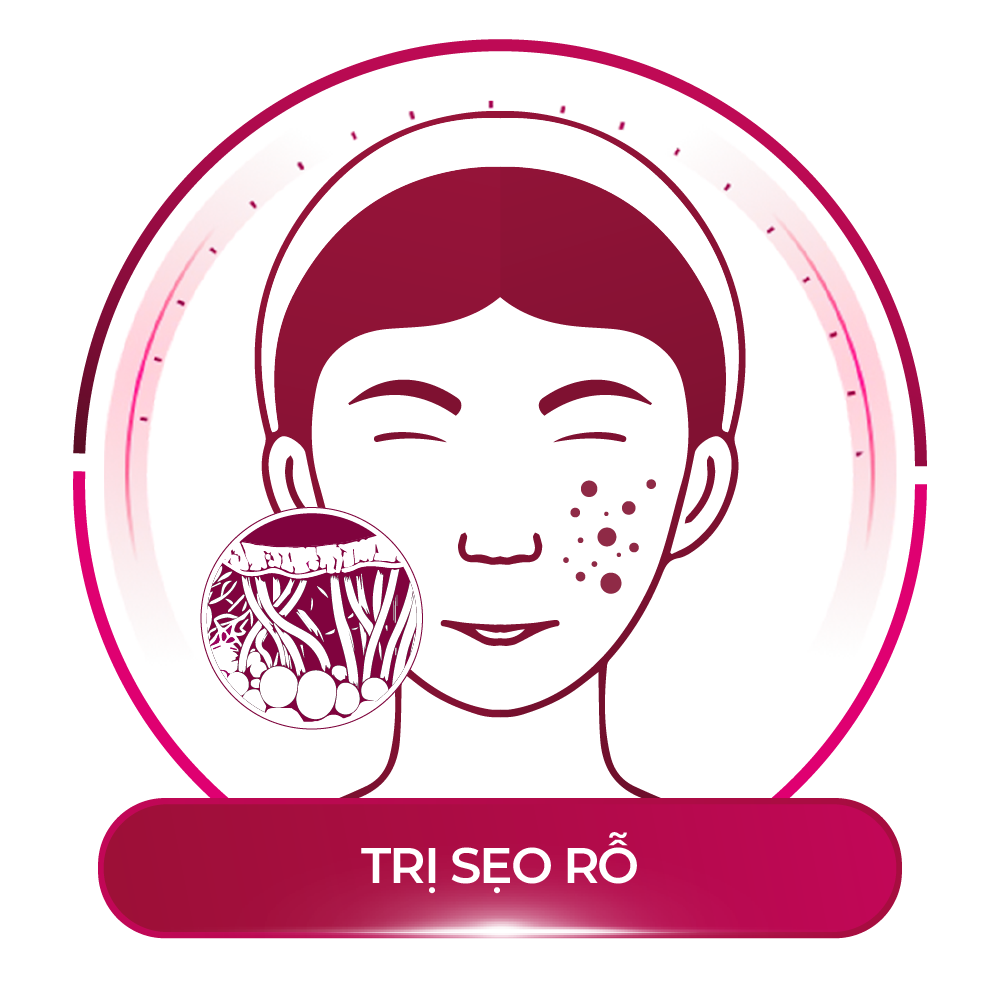 trị sẹo rỗ