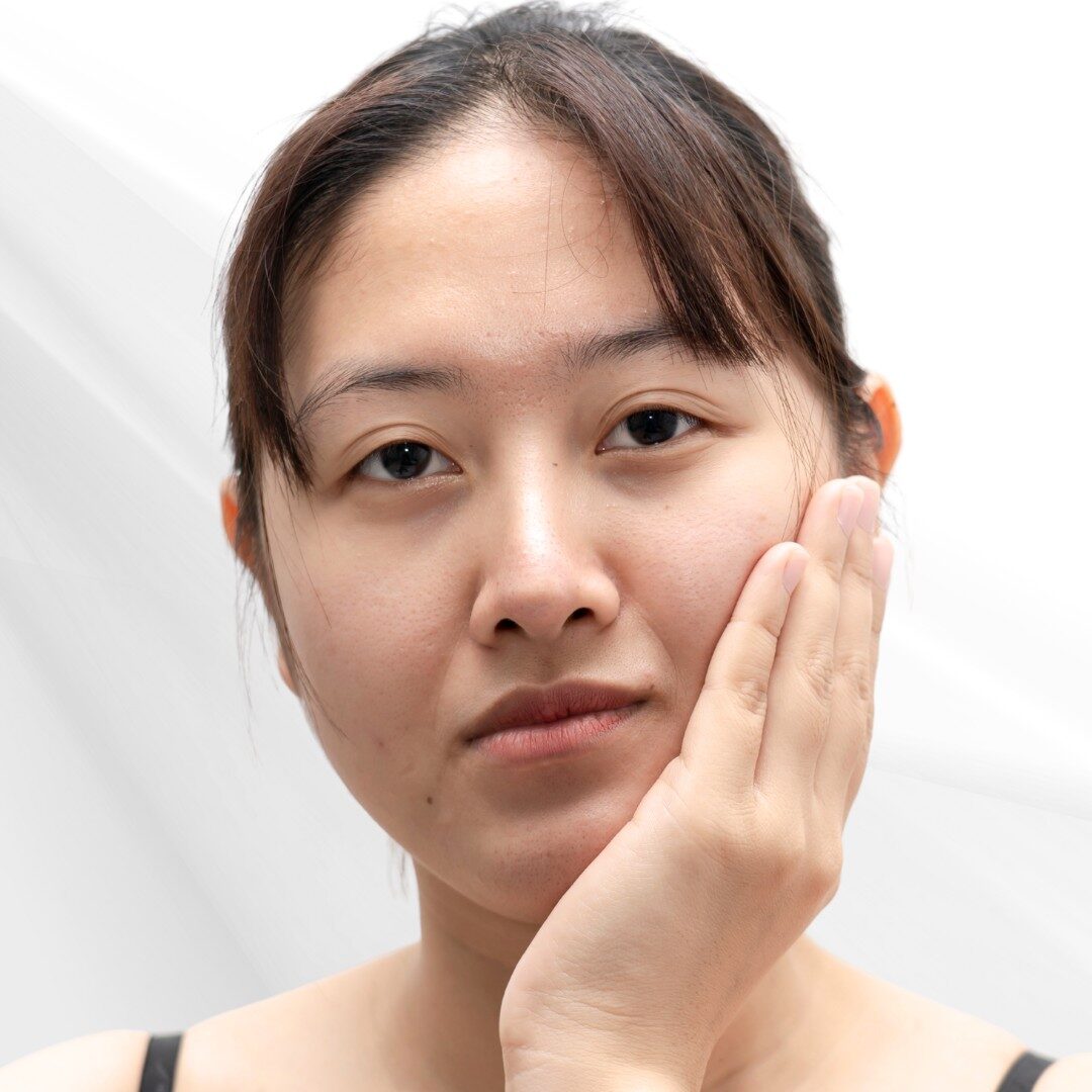 Da chảy xệ