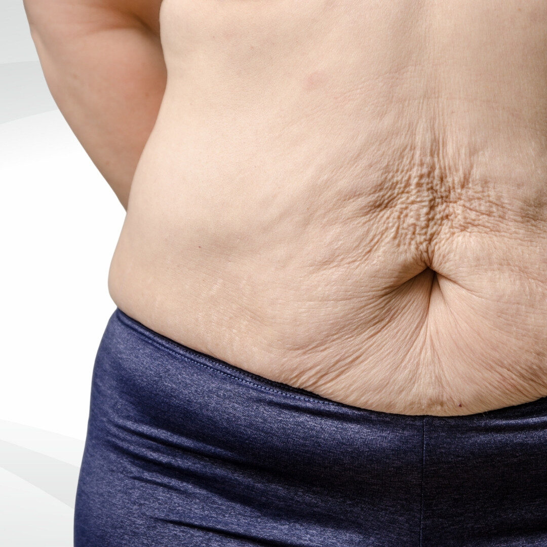 Da chùn nhão Da chùn nhão