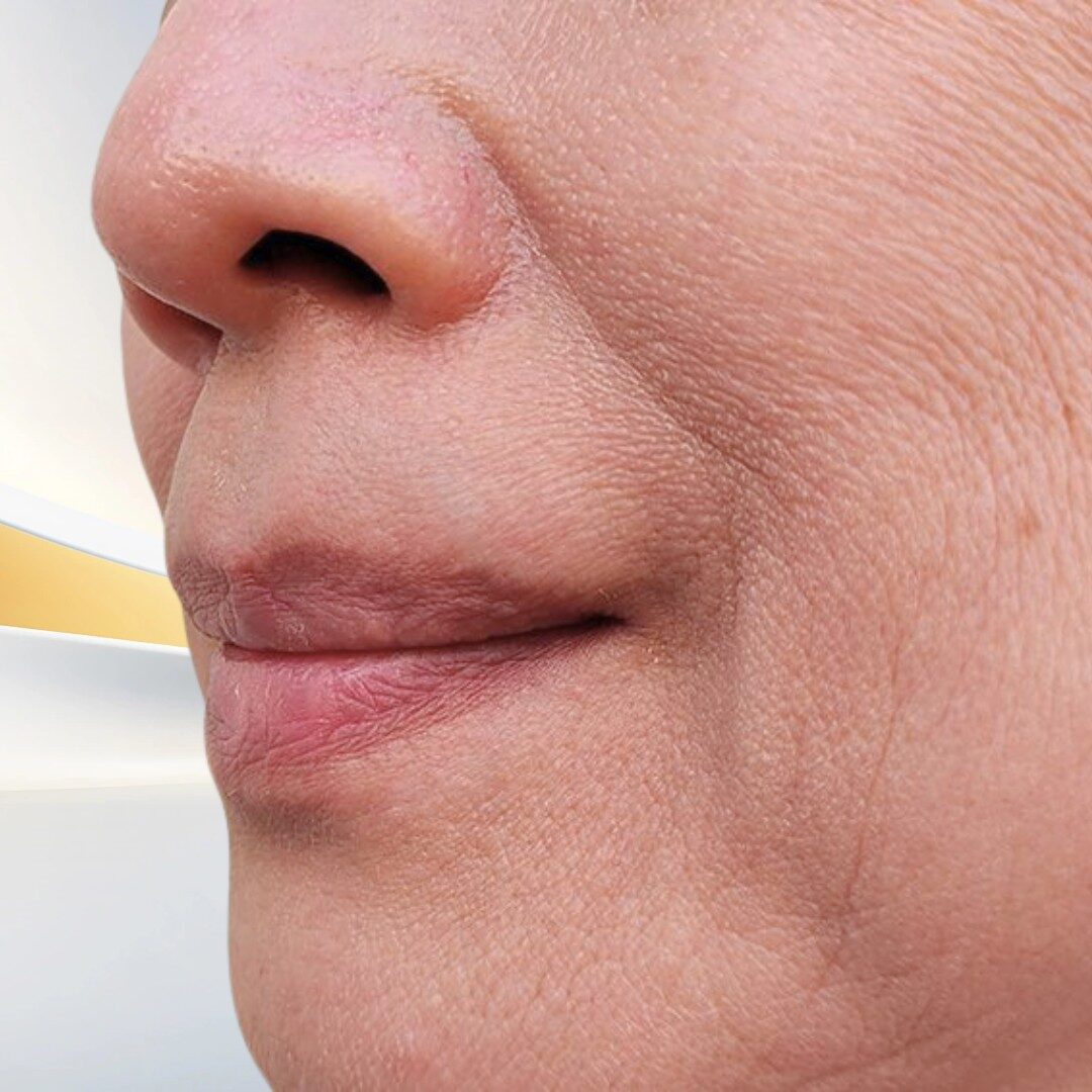 Da có nhiều nếp nhăn rãnh nhăn