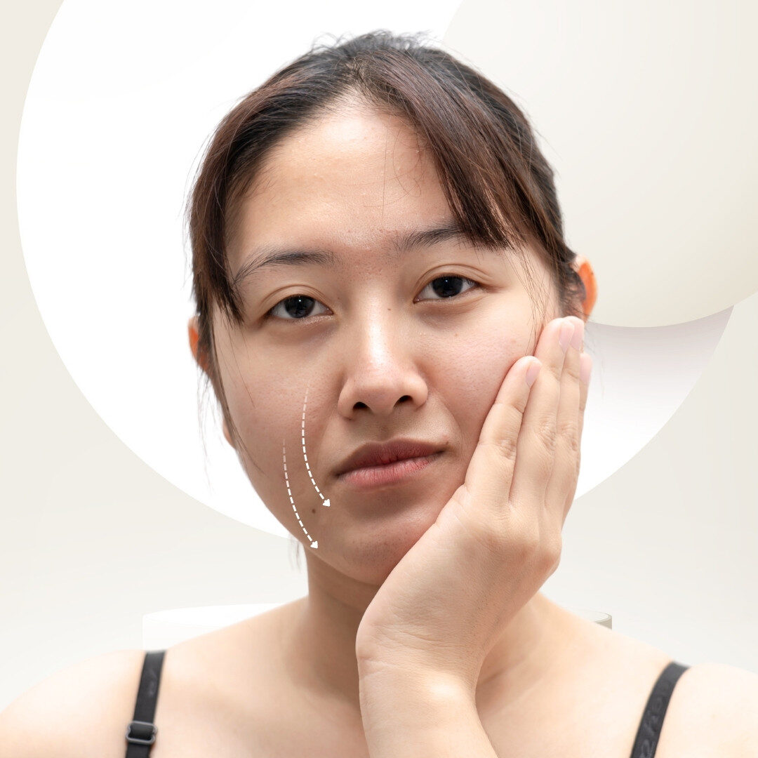 Da kém đàn hồi