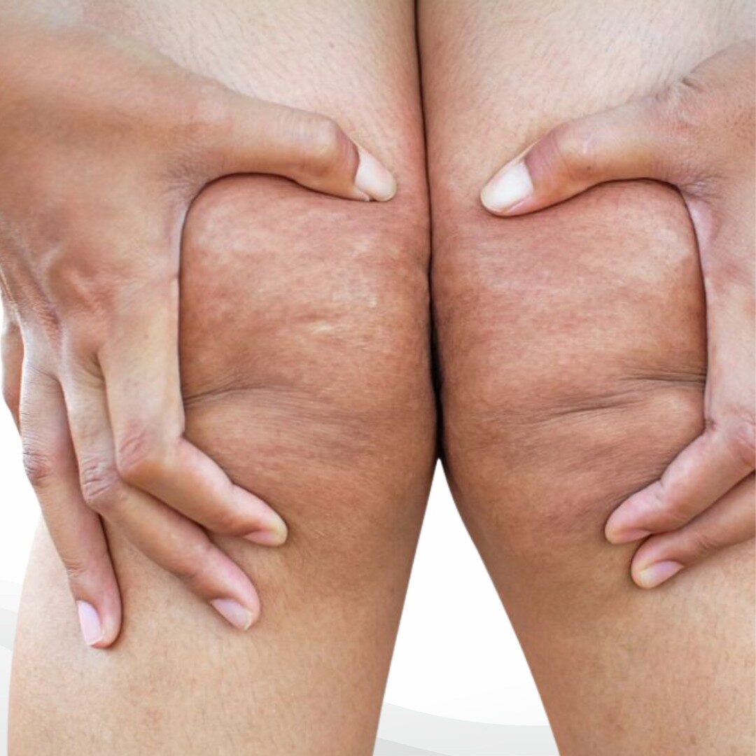 Đầu gối Đầu gối