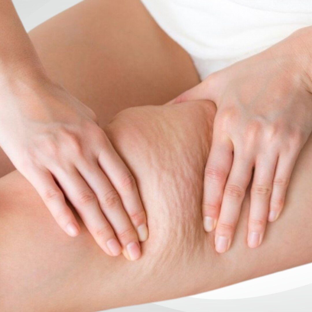 Đùi trong - đùi ngoài và mông Đùi trong - đùi ngoài và mông