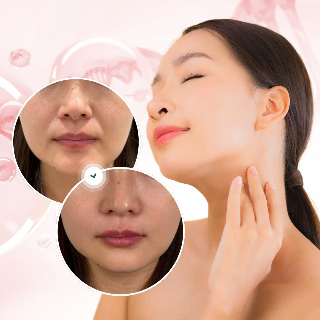 Hiệu quả trông thấy tức thì